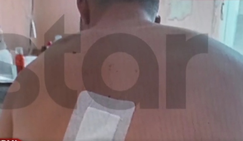 Τροχαίο με εγκατάλειψη στο Πικέρμι: «Πονάω αφόρητα, παραμορφώθηκα» λέει ο 22χρονος Άγγελος 