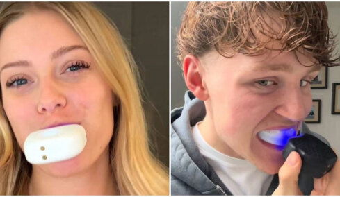 Η viral ρομποτική οδοντόβουρτσα του TikTok: Καθαρίζει τα δόντια αυτόματα (vid)