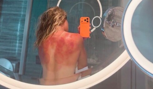 «Ο ήλιος της Αυστραλίας δεν αστειεύεται»: Το πάθημα της τενίστριας Ρενάτα Ζαραζούα πριν το Australian Open
