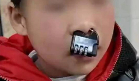 Κίνα: Αγόρι σφήνωσε λουκέτο στη μύτη του και χρειάστηκε επέμβαση πυροσβεστών για την αφαίρεση (vid)