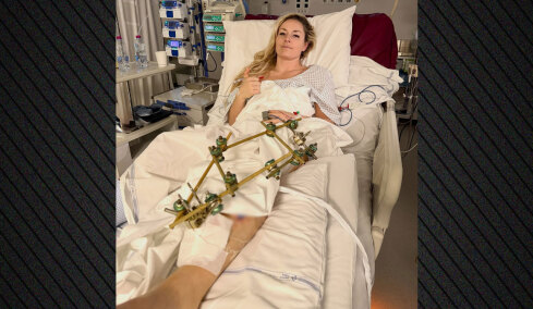 «Μπορεί να ακρωτηριαστεί το πόδι της» λέει ορθοπεδικός για τη Λίντσεϊ Βον που τραυματίστηκε σοβαρά στους Χειμερινούς Ολυμπιακούς