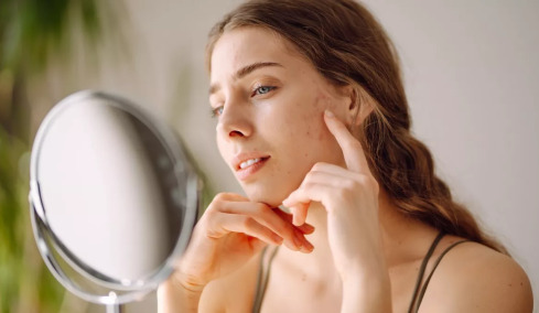 Ποιοι είναι οι μικροσκοπικοί «συγκάτοικοι» που ζουν κατά εκατομμύρια στο δέρμα; Τι λένε οι ειδικοί