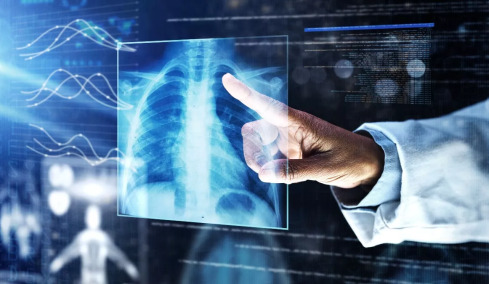 Κυστική ίνωση: Οι σύγχρονες θεραπείες που επαναπροσδιορίζουν την εξέλιξη της νόσου