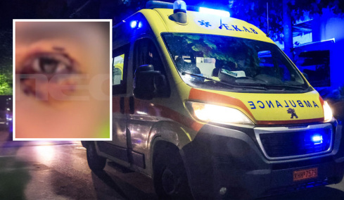 Έστησαν ενέδρα σε 16χρονο στα Ιωάννινα, τον ξυλοκόπησαν και κινδύνευσε να χάσει την όρασή του: Ο δράστης έλεγε «έβλεπα τα αίματα και τρελαινόμουν»