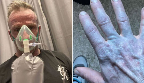 Ξύπνησε και ήταν όλος μπλε: Όταν πήγε στο νοσοκομείο οι γιατροί έκλαψαν από τα γέλια
