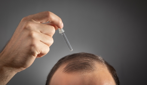 Τέλος η φαλάκρα; Νέος φυτικός ορός από την Κίνα συνδέεται με επανεμφάνιση μαλλιών μέσα σε λίγες εβδομάδες
