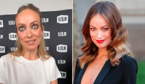 Ανησυχία για την εμφάνιση της Ολίβια Γουάιλντ: Πρώτα η Τζολί και μετά αυτή, τι συμβαίνει;