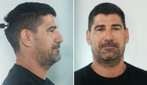 Για βιασμούς ανήλικων αθλητριών κατ’ εξακολούθηση διώκεται ο προπονητής στην Κεφαλονιά, στη δημοσιότητα τα στοιχεία του