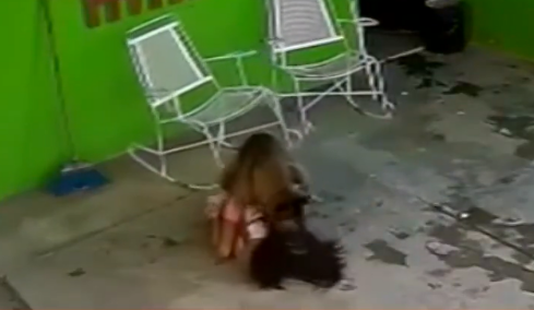 Μεξικό: Άγρια επίθεση σκύλου σε 7χρονο κορίτσι - Χρειάστηκε να της γίνουν 68 ράμματα στο κεφάλι, δείτε βίντεο