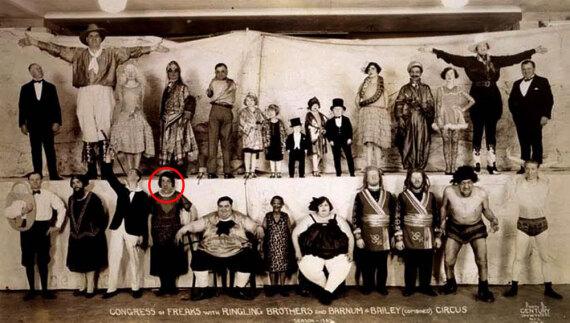 Μαίρη Αν Μπεβάν: Η ιστορία της «πιο άσχημης γυναίκας στον κόσμο»