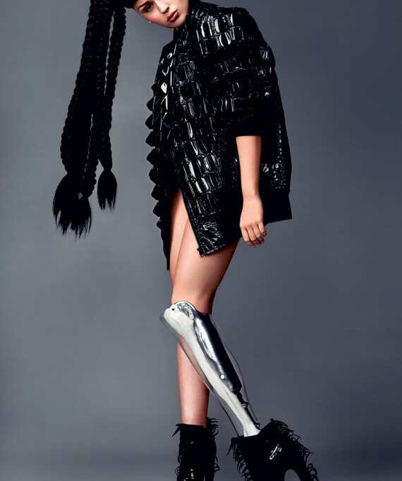 Βικτόρια Μοσάλοβα: H Bρετανίδα με το ακρωτηριασμένο πόδι που ξεπέρασε τα κοινωνικά στίγματα