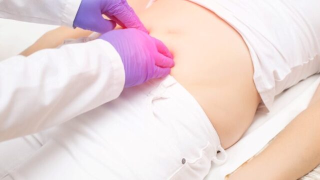 Οι 3 πιο συχνές κήλες του κοιλιακού τοιχώματος: Ολοκληρωμένος Οδηγός Διάγνωσης, Αντιμετώπισης και Θεραπείας