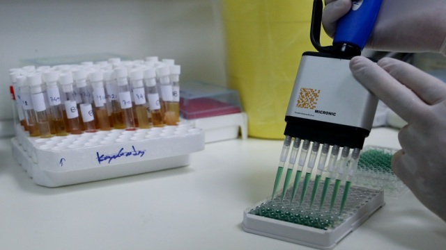 ΕΟΔΥ: 104 νέες εισαγωγές Covid 19 και 7 νέοι θάνατοι την τελευταία εβδομάδα