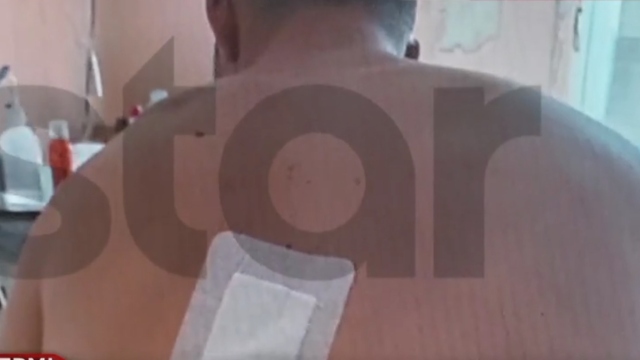 Τροχαίο με εγκατάλειψη στο Πικέρμι: «Πονάω αφόρητα, παραμορφώθηκα» λέει ο 22χρονος Άγγελος 