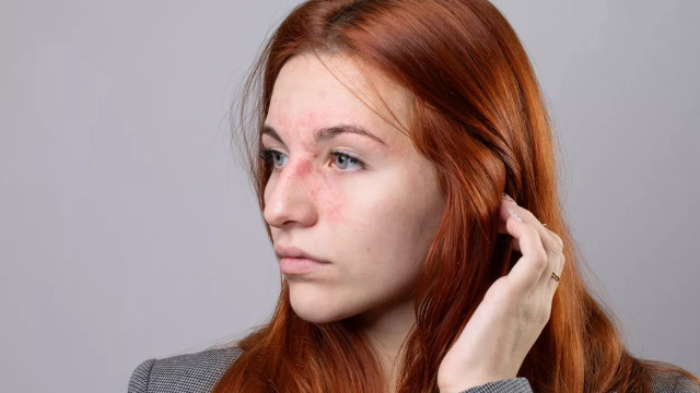 Σπάνιες παθήσεις δέρματος: Το παράδειγμα του Εθνικού Κέντρου Εμπειρογνωμοσύνης για δερματικά λεμφώματα στο ΑΤΤΙΚΟΝ