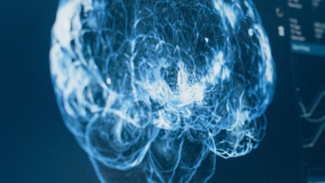 Nevron: Η νευροχειρουργική ομάδα που φέρνει την καινοτομία στο χειρουργείο