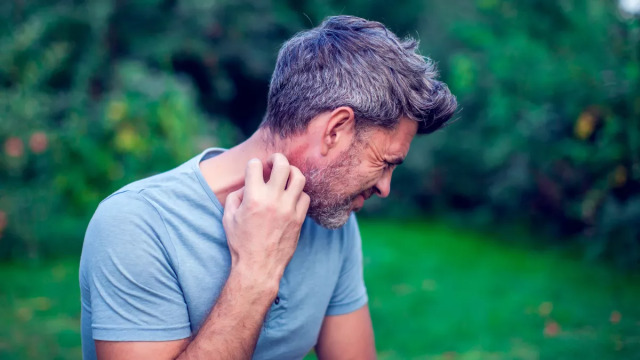 Αλλεργία και αναφυλακτικό σοκ μετά από τσίμπημα μέλισσας – Τι πρέπει να γνωρίζουμε