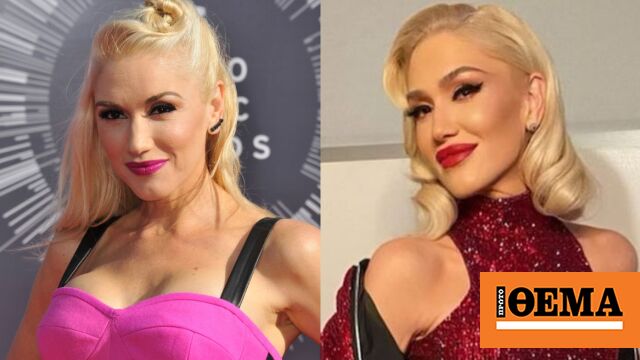 Gwen Stefani: Unrecognizable from plastic surgery