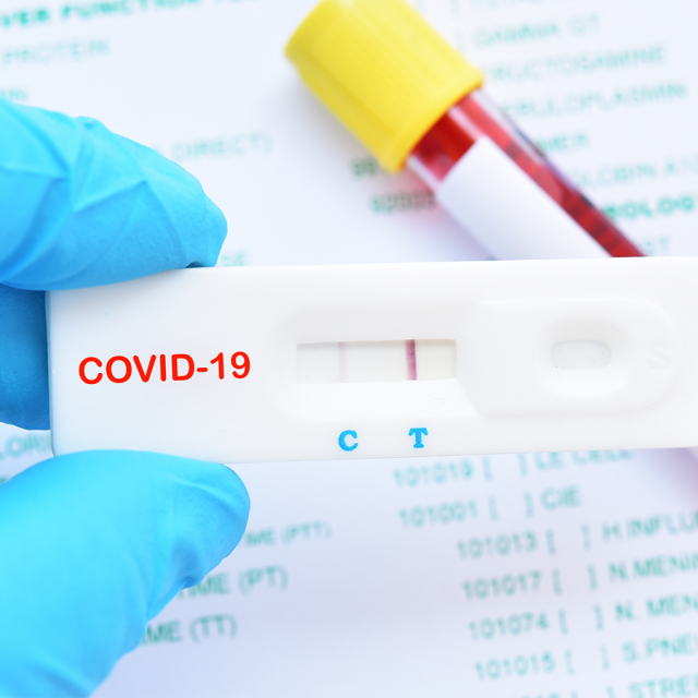 Δωρεάν ατομικά rapid test: Μαζικά κατ' οίκον τεστ για τον έλεγχο της πανδημίας