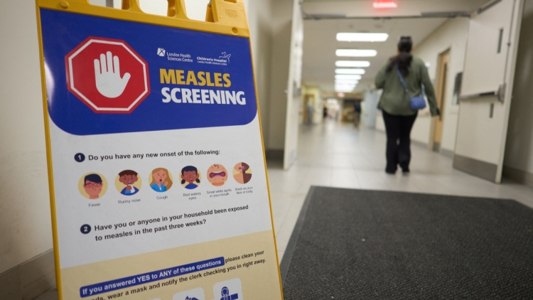 Η ιλαρά «επέστρεψε» στον Καναδά - Χιλιάδες κρούσματα και δύο νεκρά βρέφη, καθώς εμβολιάζεται όλο και λιγότερος κόσμος