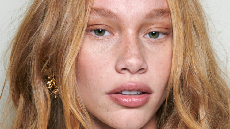 Σημάδια ακμής στην επιδερμίδα; Με αυτά τα tips θα τα εξαφανίσετε