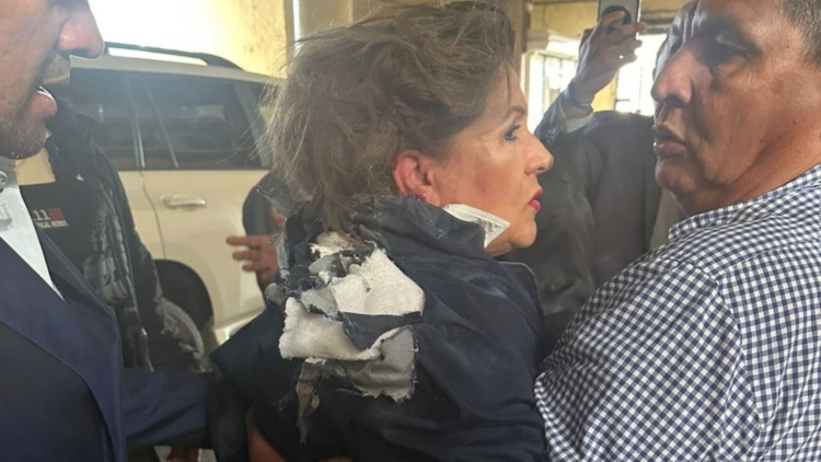 Σοβαρά τραυματισμένη βουλευτής από εκρηκτικό μηχανισμό στο Κοινοβούλιο της Ονδούρας, δείτε βίντεο