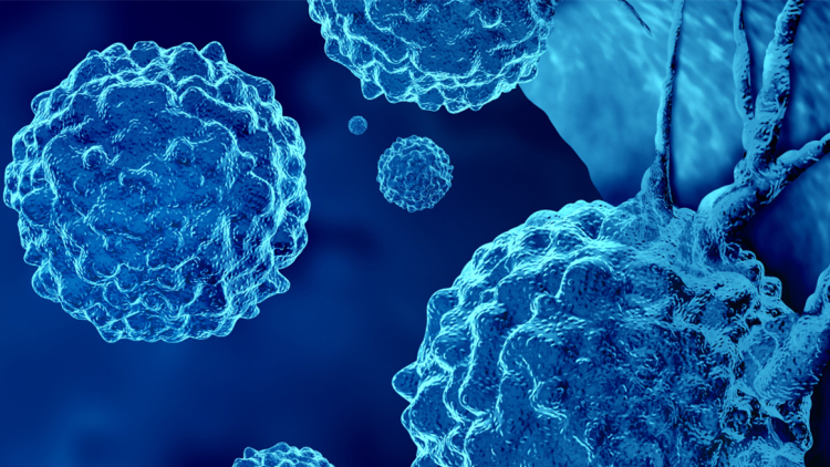 Μεταστατικός καρκίνος: Όταν δεν εντοπίζεται η αρχική εστία