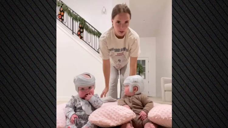 Οργή στις ΗΠΑ με influencer που φορά κράνη για 23 ώρες την ημέρα στα μωρά της για να αλλάξει το σχήμα του κεφαλιού τους