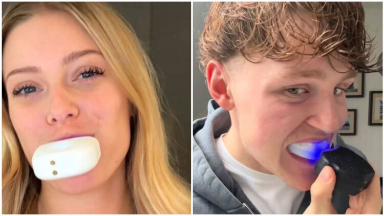 Η viral ρομποτική οδοντόβουρτσα του TikTok: Καθαρίζει τα δόντια αυτόματα (vid)