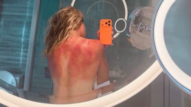 «Ο ήλιος της Αυστραλίας δεν αστειεύεται»: Το πάθημα της τενίστριας Ρενάτα Ζαραζούα πριν το Australian Open
