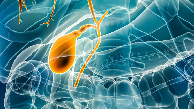 Χοληδόχος Κύστη και Πολύποδες: Διάγνωση και θεραπεία