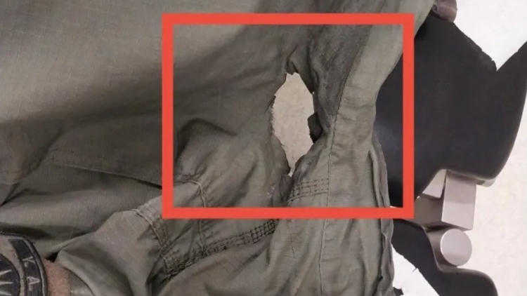 Η μολότοφ που πέταξαν σε αστυνομικό στα επεισόδια του ΑΠΘ άνοιξε τρύπα στη στολή του, δείτε φωτογραφία