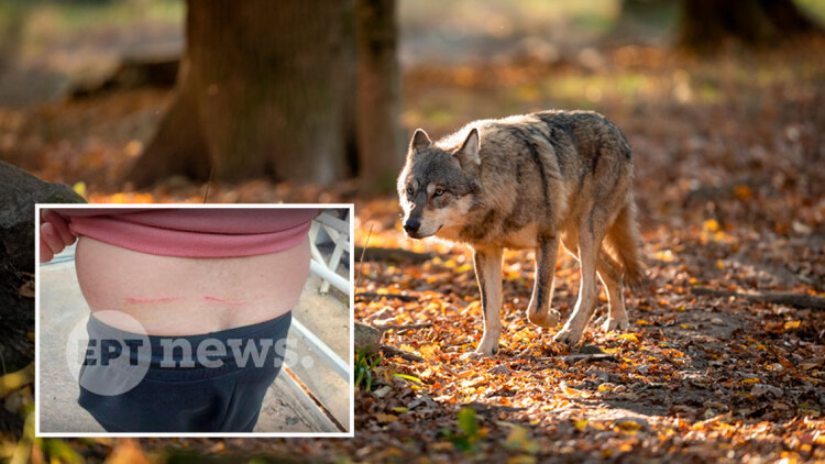 «Μου έσκισε τη μπλούζα και μου έκανε γρατζουνιές»: Πώς σώθηκε ο άνδρας που δέχθηκε επίθεση από λύκο στο Τατόι