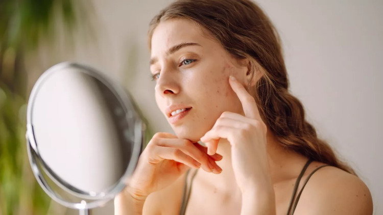 Ποιοι είναι οι μικροσκοπικοί «συγκάτοικοι» που ζουν κατά εκατομμύρια στο δέρμα; Τι λένε οι ειδικοί