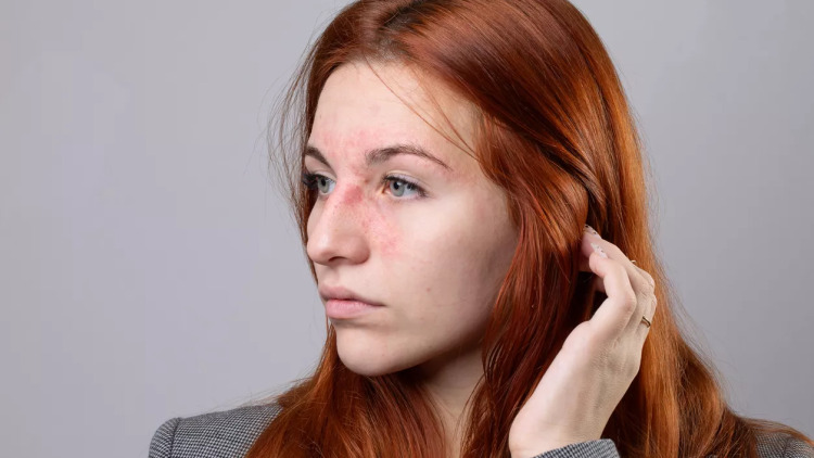 Σπάνιες παθήσεις δέρματος: Το παράδειγμα του Εθνικού Κέντρου Εμπειρογνωμοσύνης για δερματικά λεμφώματα στο ΑΤΤΙΚΟΝ