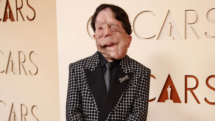 Η εμφάνιση του Άνταμ Πίρσον που πάσχει από νευροϊνωμάτωση στα φετινά Όσκαρ