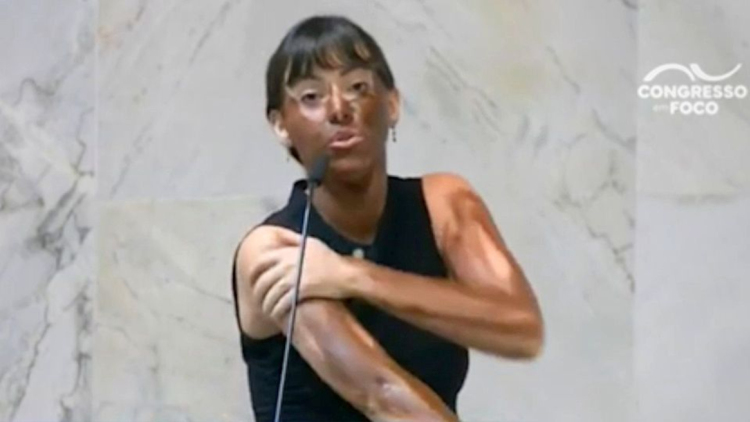 Βουλευτής στη Βραζιλία έβαψε το πρόσωπό της σε ομιλία κατά των δικαιωμάτων των τρανς ατόμων, την κατηγορούν για ρατσισμό