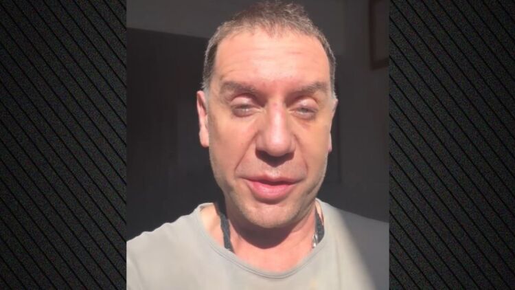 Γιώργος Μαζωνάκης: Μην ξανακούσω κανέναν να λέει ότι δεν θα γίνει η συναυλία μου λόγω του ματιού μου, θα του κόψω το κεφάλι 