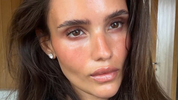 Η skincare ρουτίνα που χρειάζεται η επιδερμίδα μας μετά από ένα ηλιακό έγκαυμα
