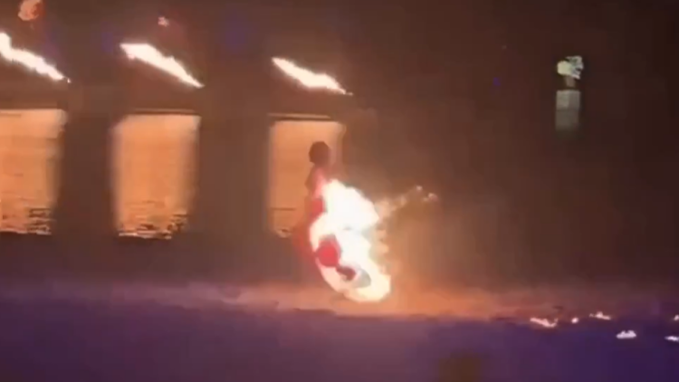 Τρομακτικό ατύχημα στην Κίνα: Φόρεμα χορεύτριας έπιασε φωτιά, η καλλιτέχνης υπέστη εγκαύματα και νοσηλεύεται, δείτε βίντεο