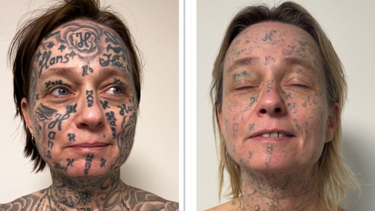 Απίστευτη κακοποίηση στην Ολλανδία: Έκανε τατουάζ 250 φορές το όνομά του στο κορμί της κοπέλας του!