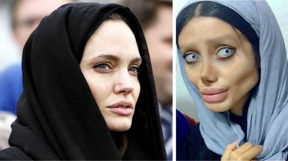Real Or Fake Iranian Teen Claims She Did 50 Plastic Surgeries To Look Like Angelina Jolie Photos