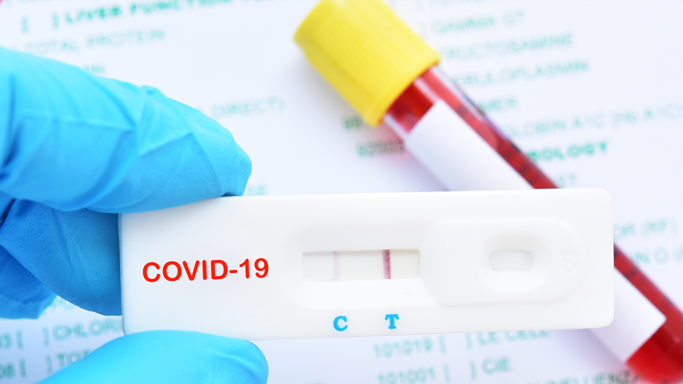 COVID-19-coronavirus-diagnostic-test