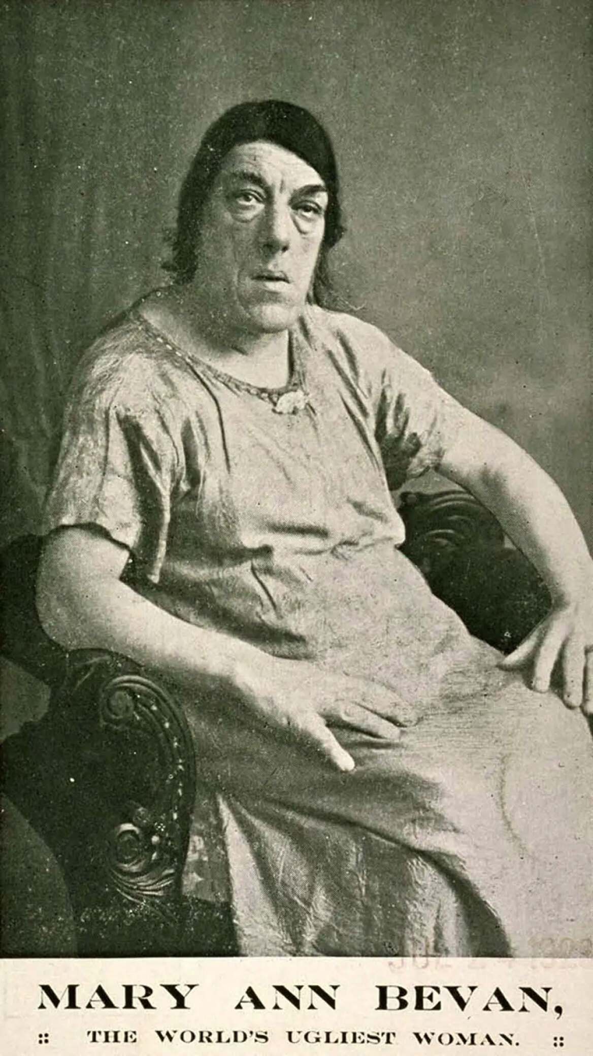 Μαίρη Αν Μπεβάν: Η ιστορία της «πιο άσχημης γυναίκας στον κόσμο»
