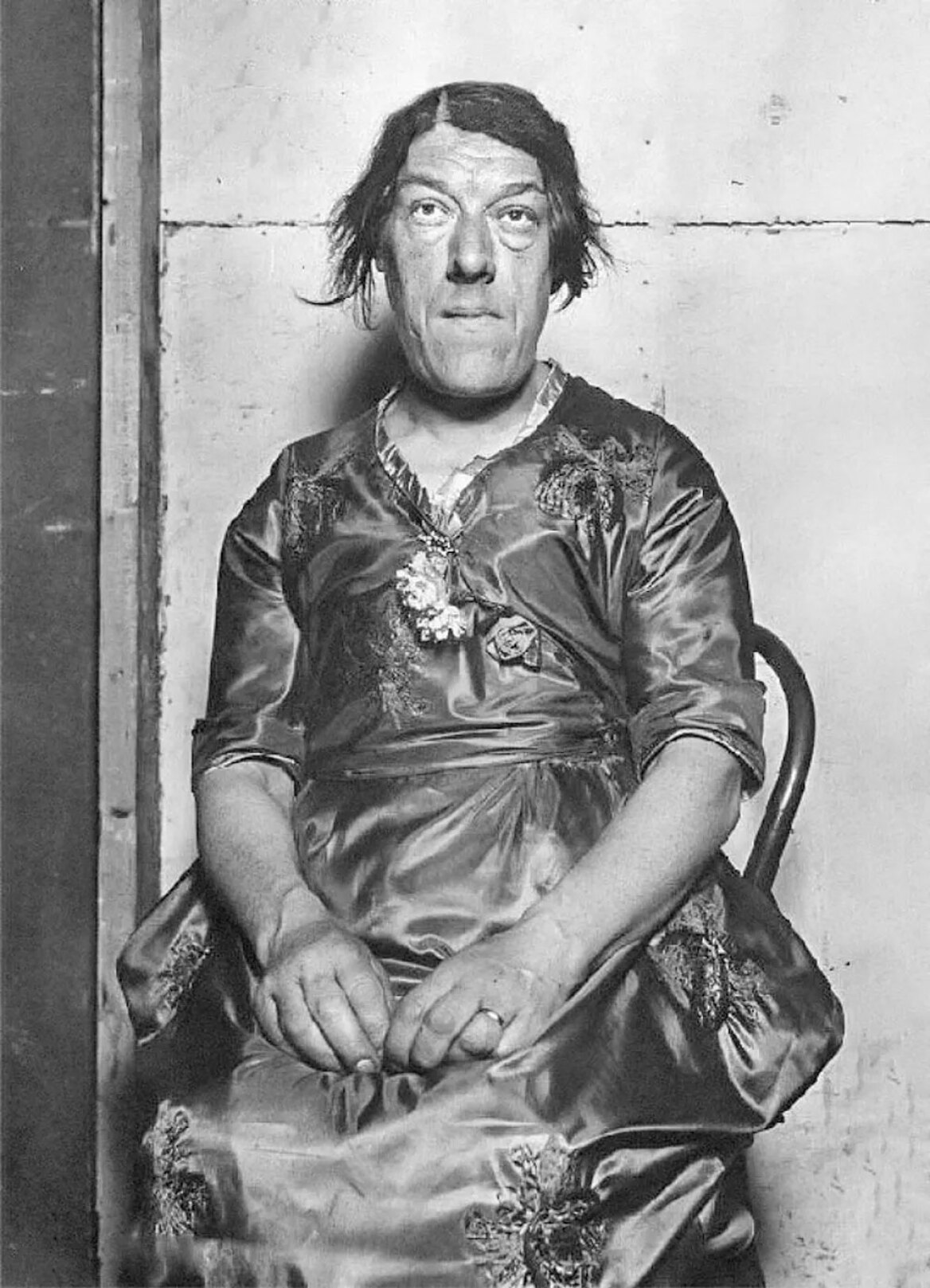 Μαίρη Αν Μπεβάν: Η ιστορία της «πιο άσχημης γυναίκας στον κόσμο»