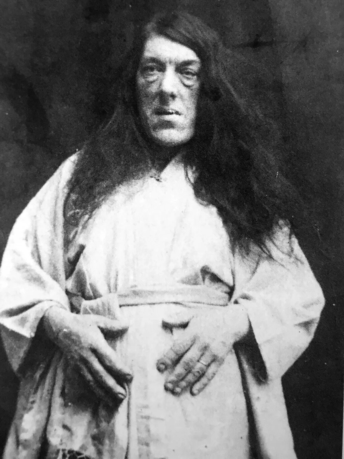 Μαίρη Αν Μπεβάν: Η ιστορία της «πιο άσχημης γυναίκας στον κόσμο»