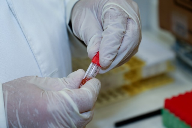 ΕΟΔΥ: Δύο θάνατοι από COVID-19 και δύο με γρίπη