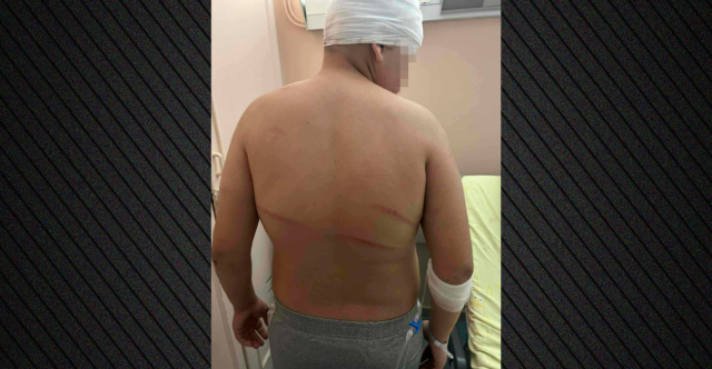 Σε κατ’ οίκον περιορισμό ο 18χρονος για την άγρια επίθεση σε 13χρονο στη Θεσσαλονίκη μετά από διαφωνία εισαγγελέα και ανακριτή