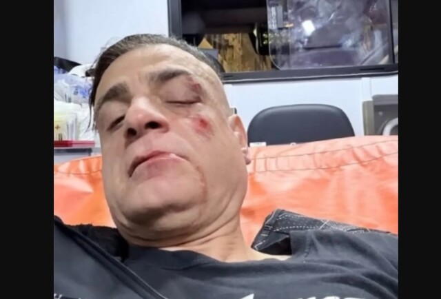 Άγριος ξυλοδαρμός Youtuber στο μετρό της Ρώμης - Του επιτέθηκαν οι πορτοφολάδες που βιντεοσκοπούσε, δείτε βίντεο