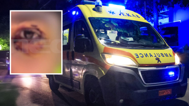 Έστησαν ενέδρα σε 16χρονο στα Ιωάννινα, τον ξυλοκόπησαν και κινδύνευσε να χάσει την όρασή του: Ο δράστης έλεγε «έβλεπα τα αίματα και τρελαινόμουν» 